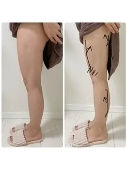 美尻