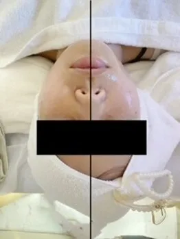 小顔